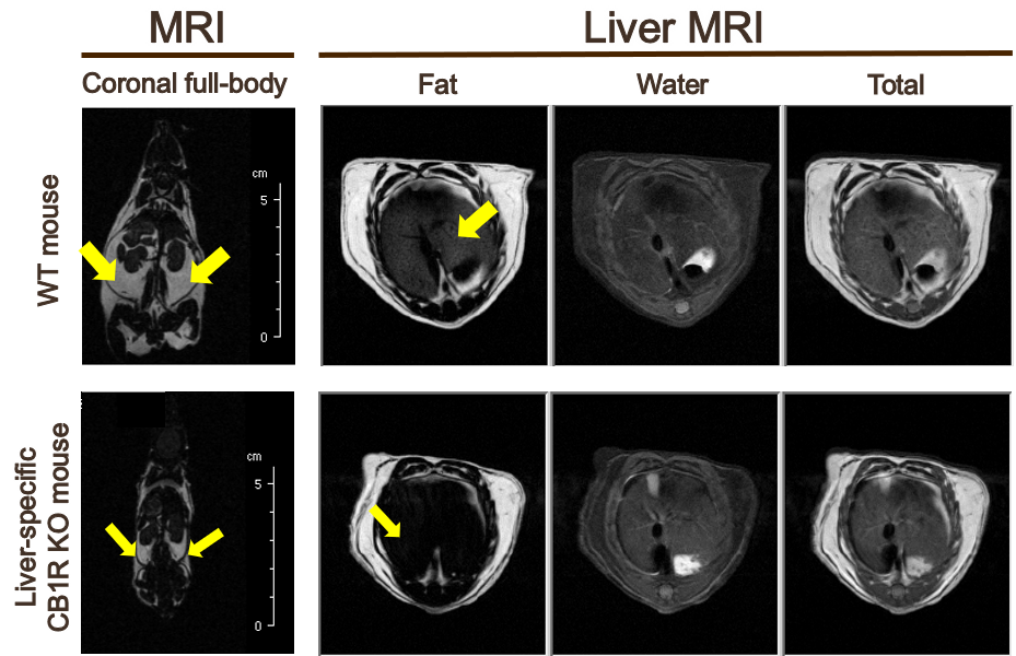 photo of an MRI